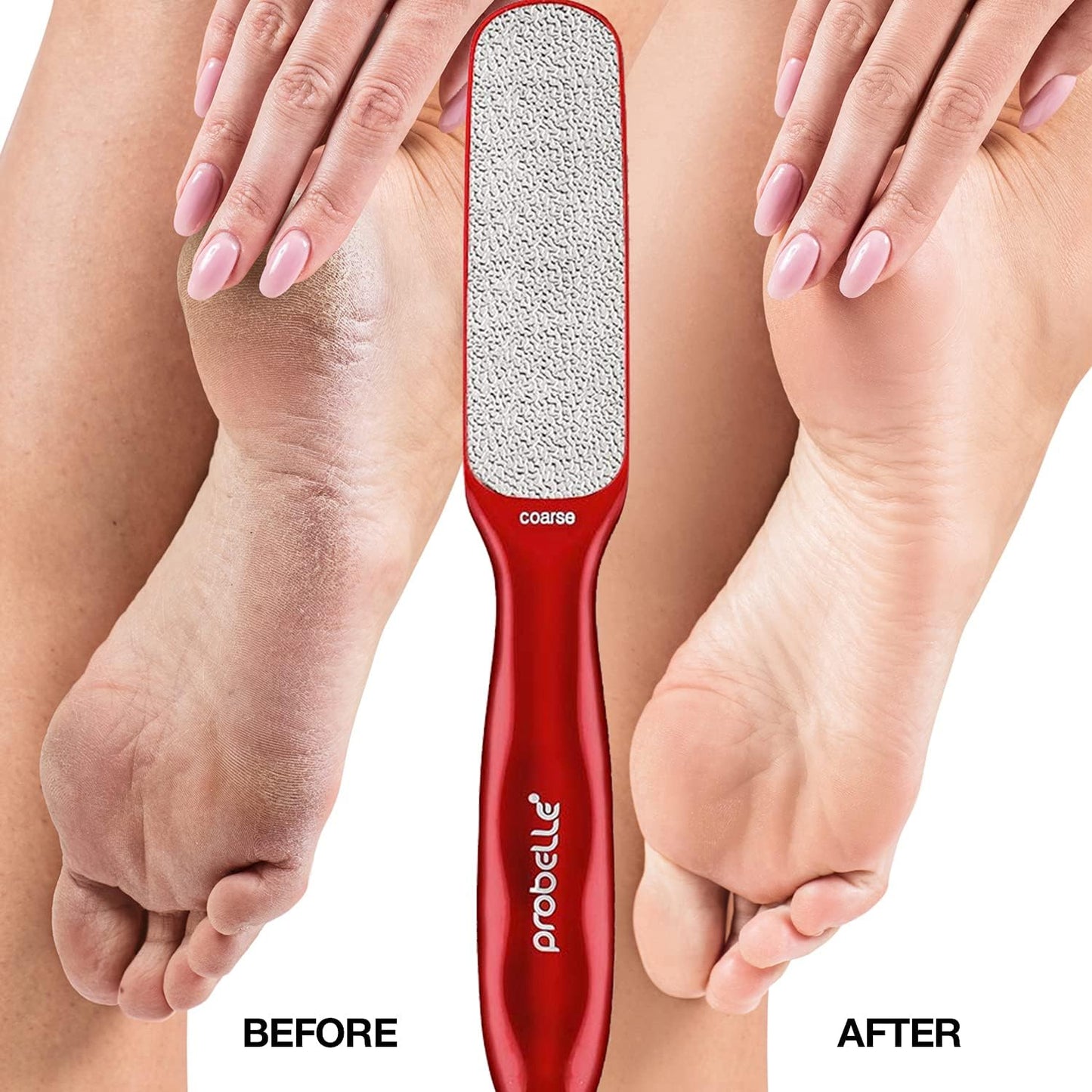 Double Sided Multidirectional Nickel Foot File Callus Remover - Immediately Reduces Calluses and Corns to Powder for Instant Results, Safe Tool (Red)